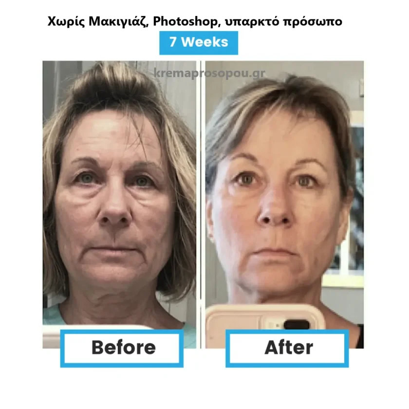 Γλουταθειόνη Neumi Skin σε Spray