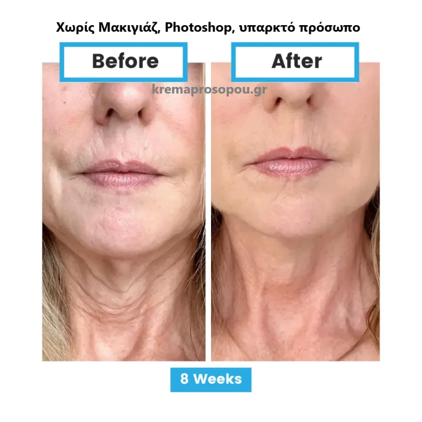 Γλουταθειόνη Neumi Skin σε Spray